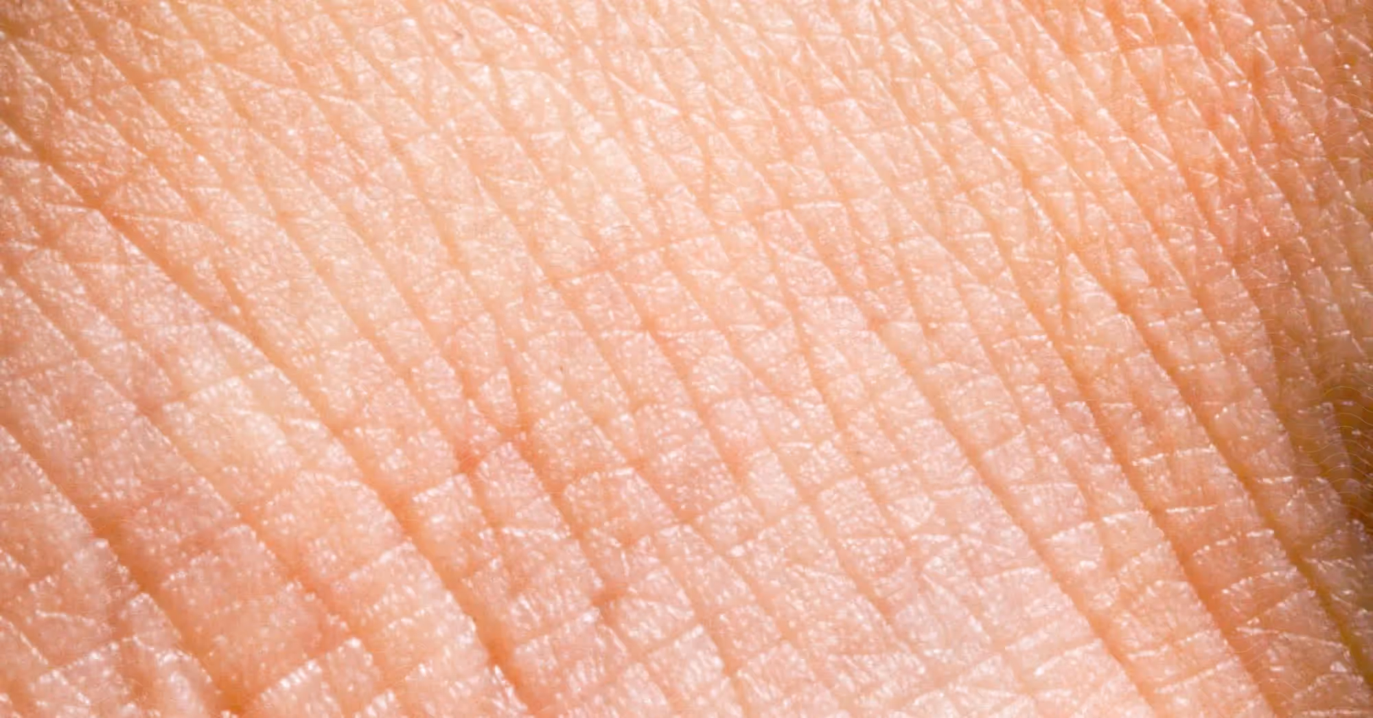 Close-up of aged skin showing visible texture and fine lines