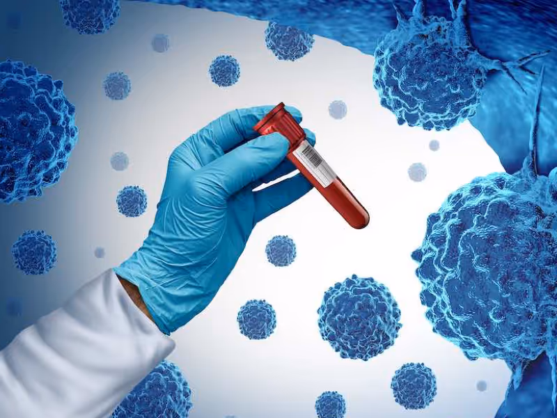 Cancer Blood Test