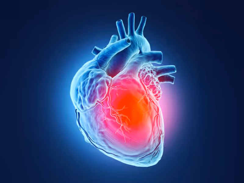 Heart CT Scan
