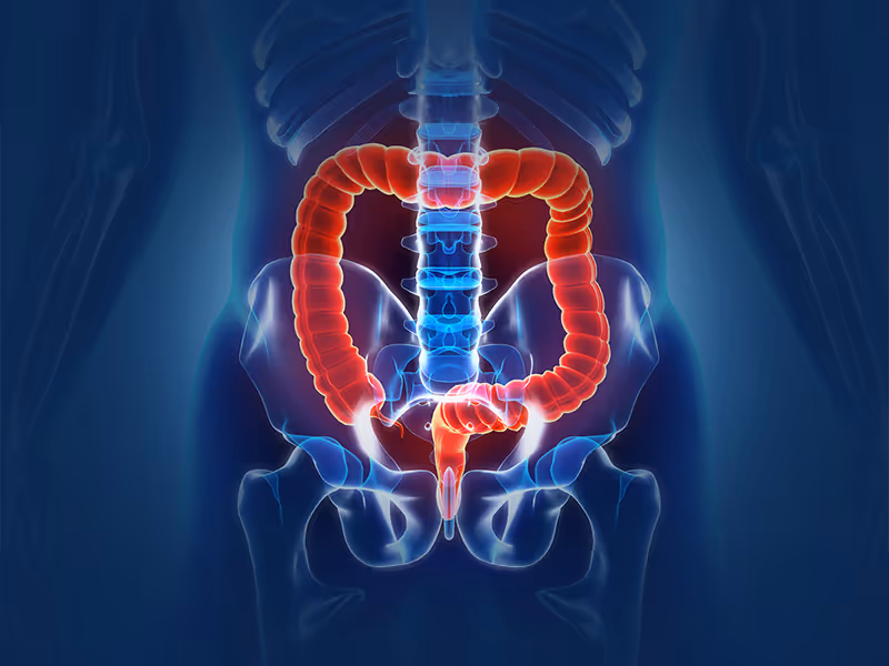 Virtual Colonoscopy